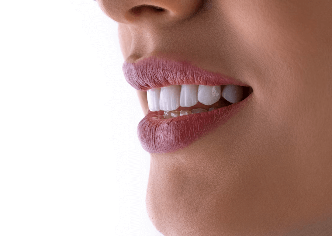 Mulher sorrindo feliz pois fez seu proceminto dental com uma clinica deconfiança