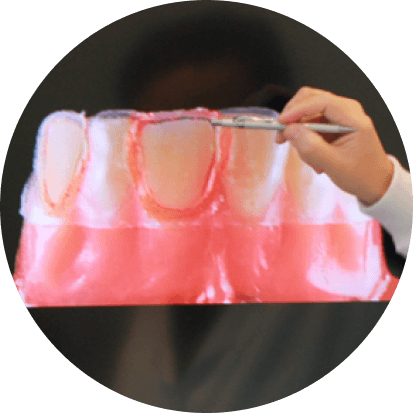Cirurgia Corretiva de Gengiva