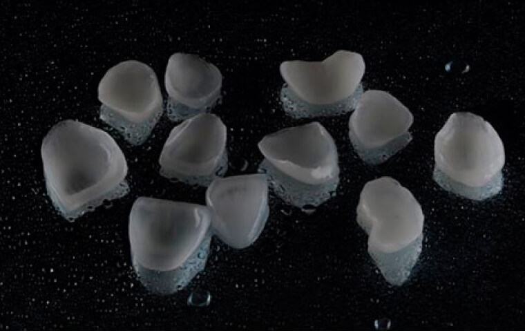 Imagem de lentes de contato dental