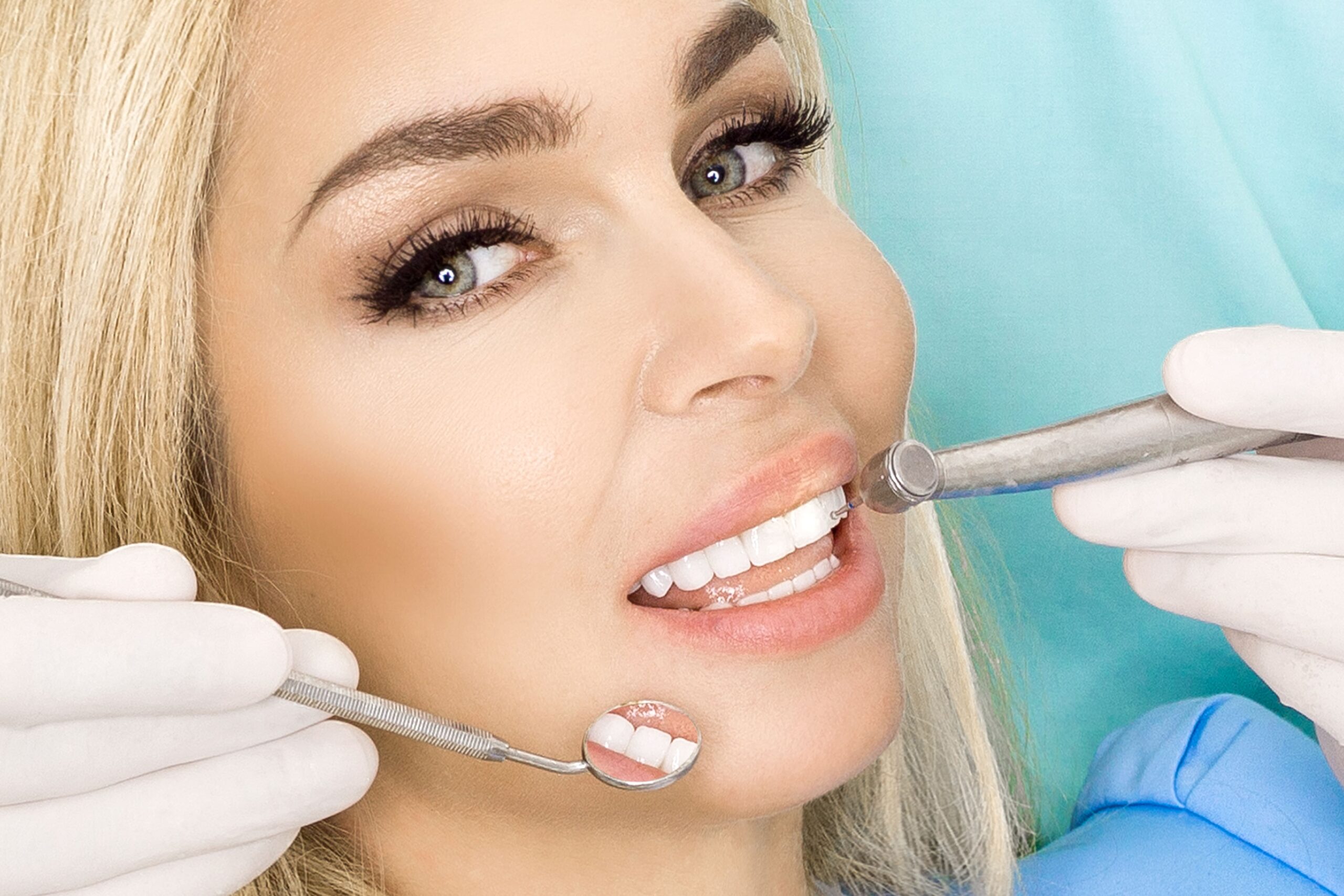 mulher usando facetas-dentarias