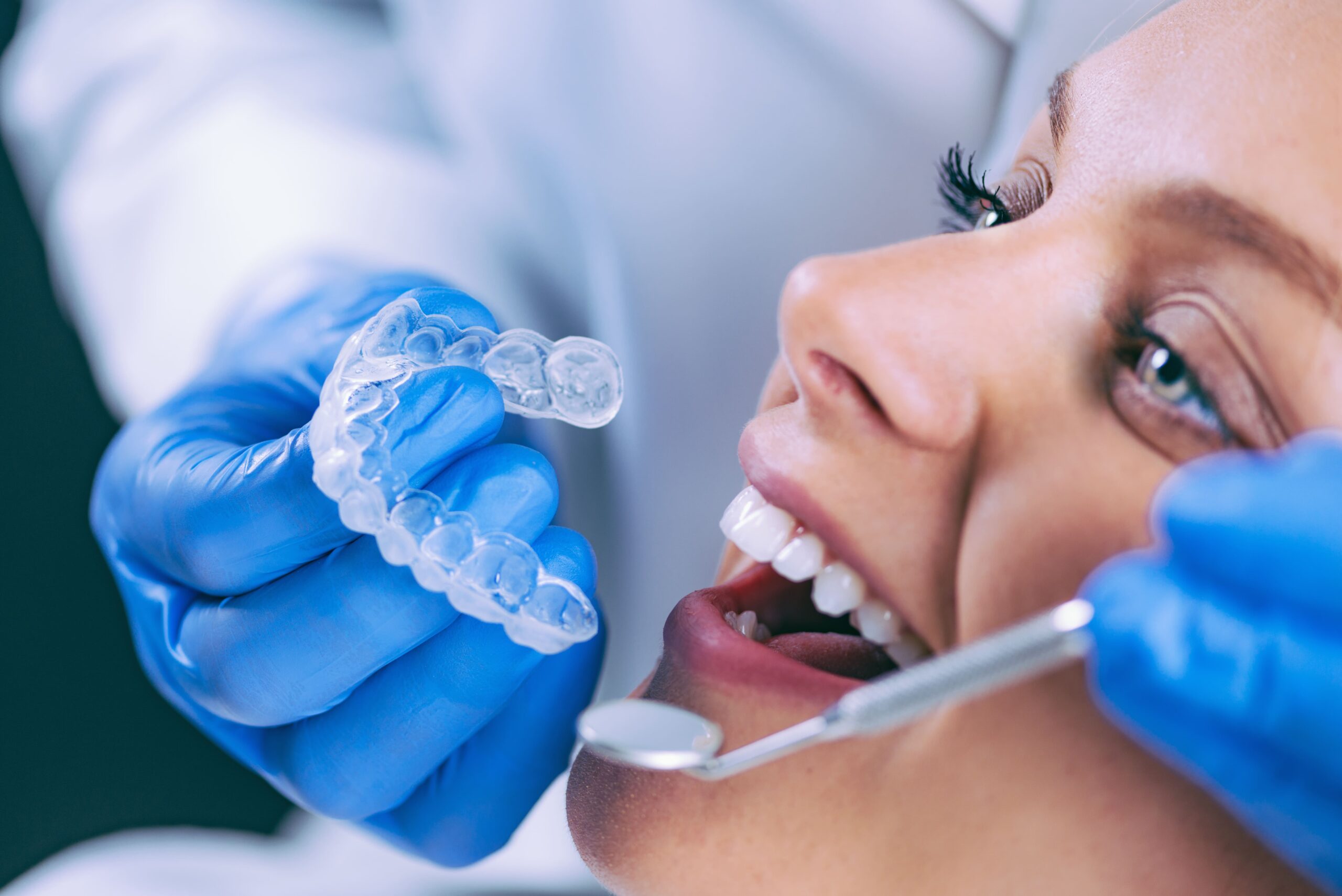 odontologia estética em Curitiba