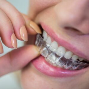 A imagem mostra alguém com um aparelho dental