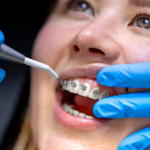 Imagem próxima do rosto e boca aberta no dentista analisando e ajustando aparelho dentário.