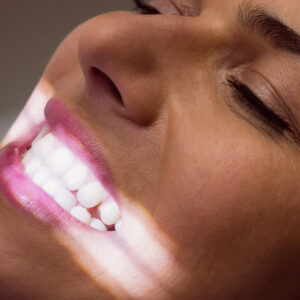rosto mulher fazendo clareamento dental